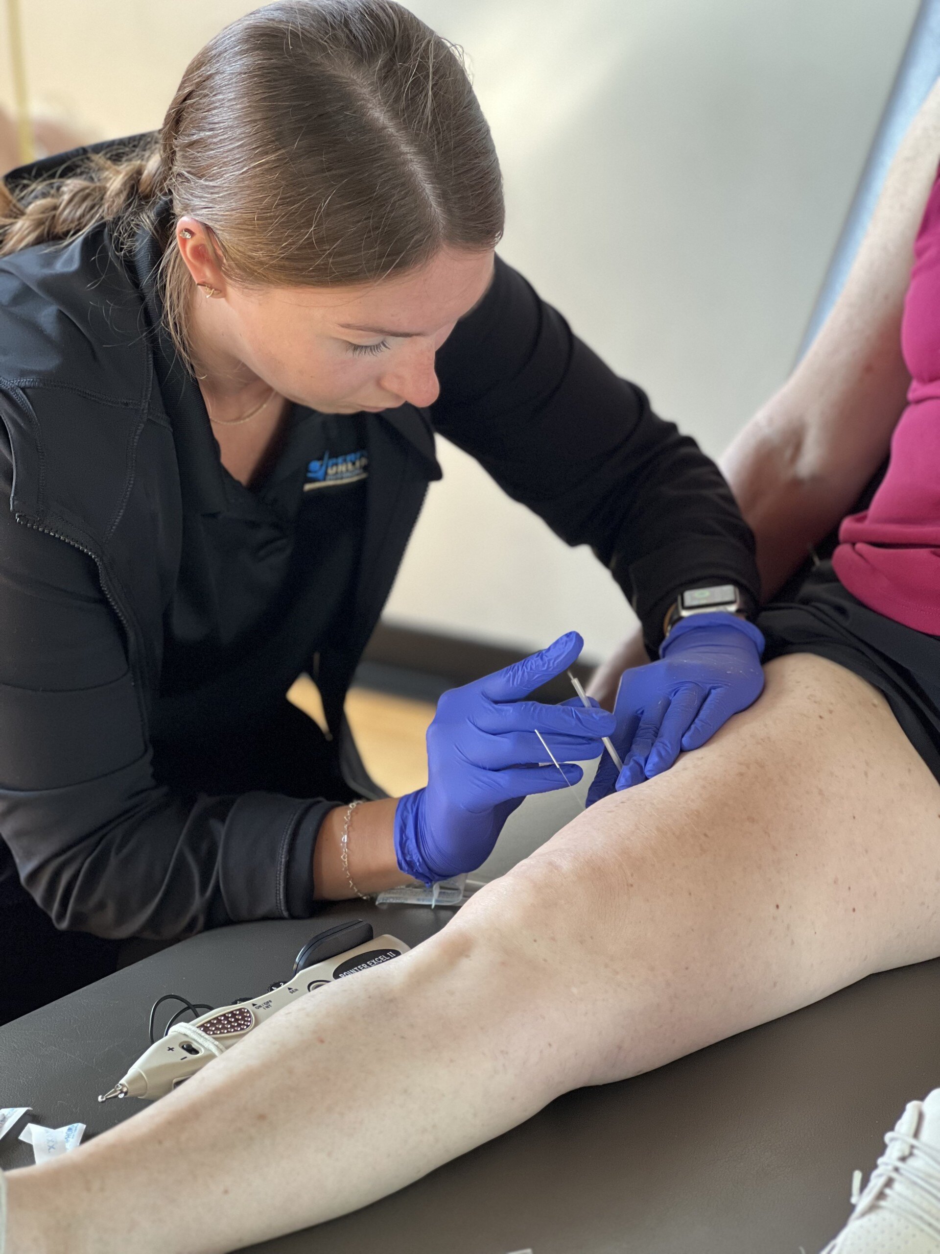 dry-needling-physical-therapy